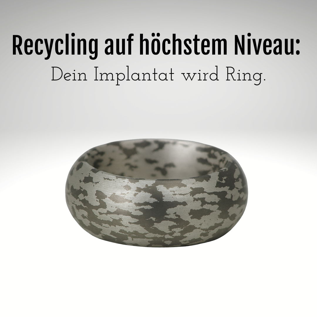 Titan Silber Ring aus Implantat in Mokume Gane